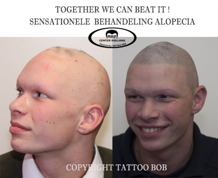 Twijfel dus niet langer en maak snel een afspraak bij Tattoo Bob MHP center voor het plaatsen van een gratis proefstukje. Laat u verbazen over de revolutionaire resultaten van Micro Haar Pigmentatie ofwel stoppeltattoo