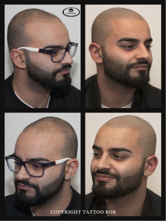 Arabische jongen met micro haar pigmentatie