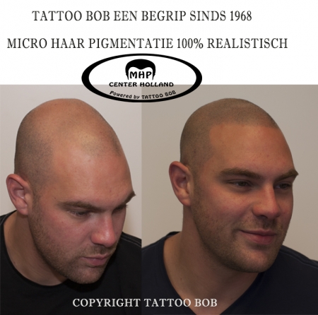 Voor en na foto van een micro haar pigmentatie door tattoo Bob Rotterdam